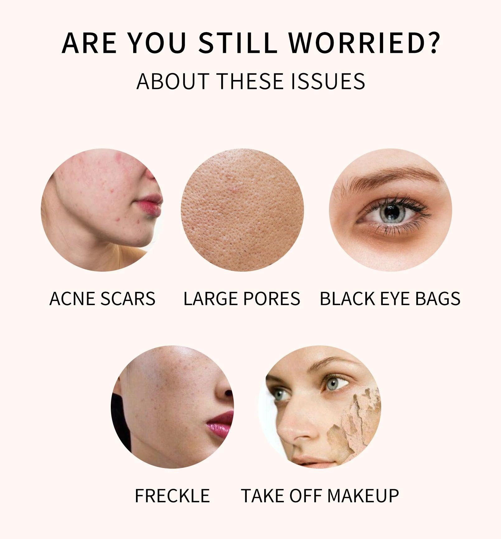 High Coverage Concealer Cover Anti Dark Circle Freckle Long-lasting Waterproof Foundation BB Cream for Face Makeup Base Cosmetic - MANDOTOS