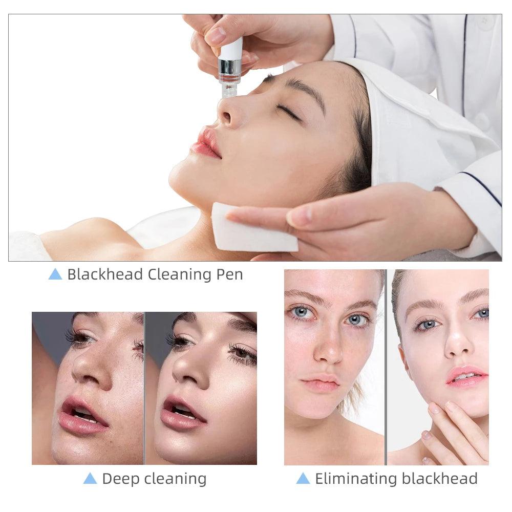Hydro Water Oxygen Jet Peel Machine Oxy Spray Facial Machine Face Cleaning RF Lifting Dermabrasion Skin Care Beauty Device Spa - MANDOTOS