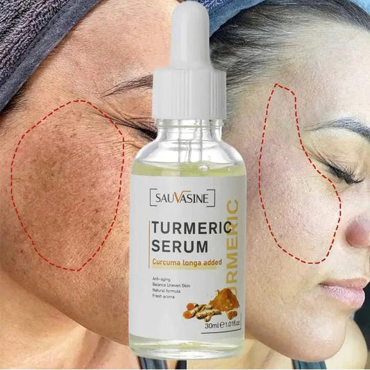 Mandotos BrightGlow Turmeric Radiance Serum bottle with label and dropper cap, displayed on a neutral background.