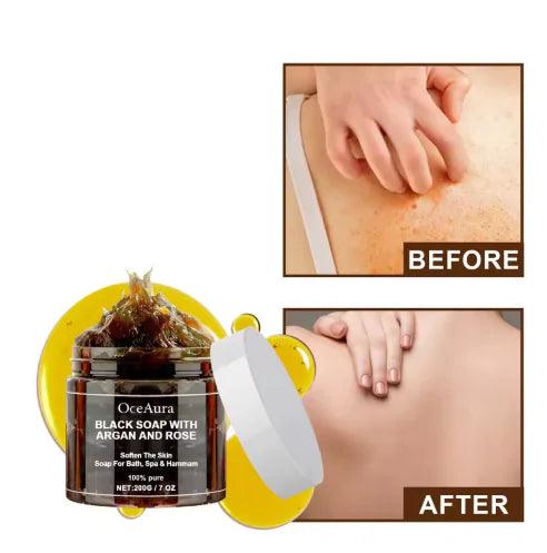 Argan Rose Black Soap - MANDOTOS