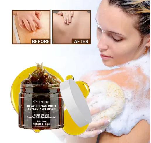 Argan Rose Black Soap - MANDOTOS