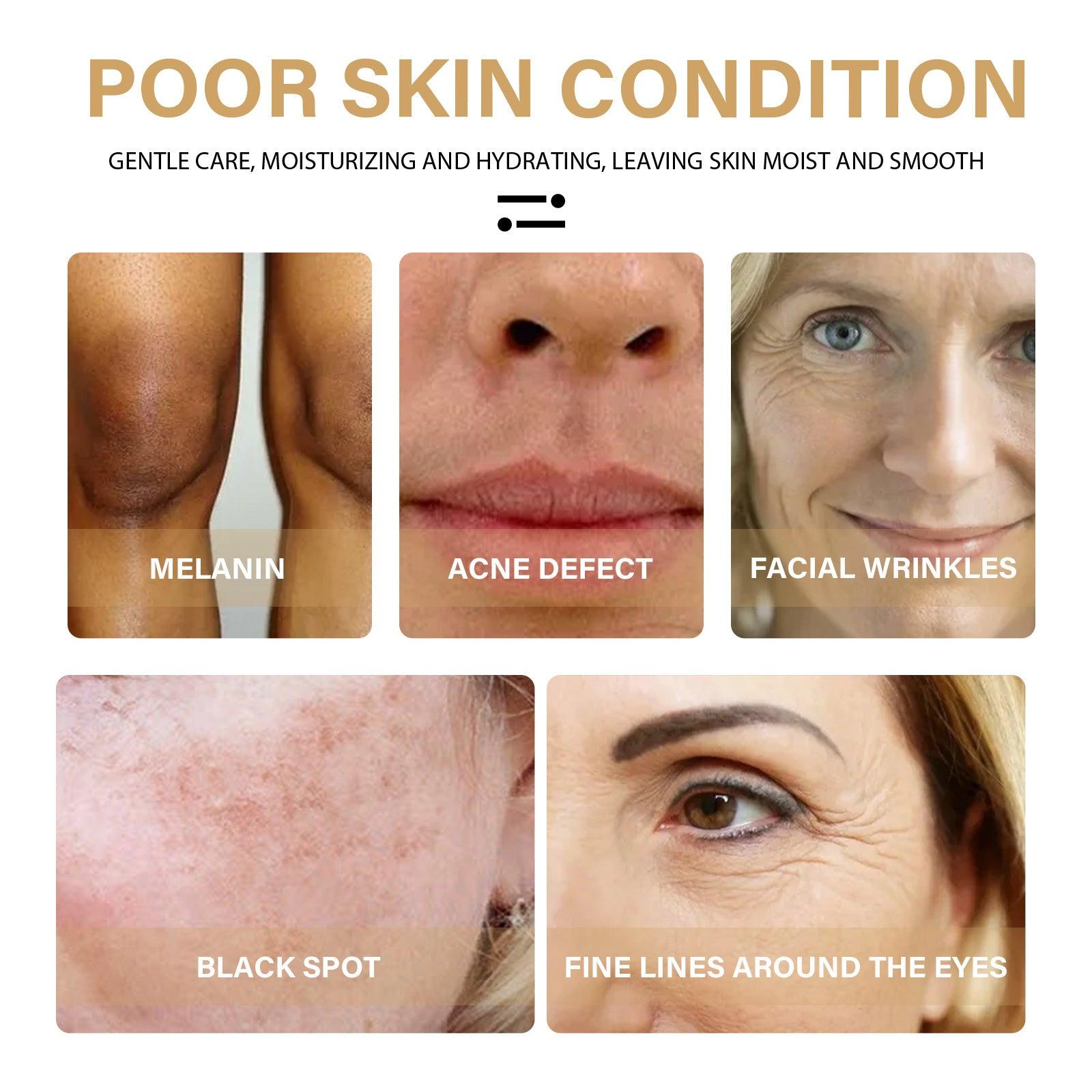 EELHOE Turmeric Dark Spot Correcting Serum Face Care Spot Moisturizing Nourishing Repairing Complexion Serum - MANDOTOS