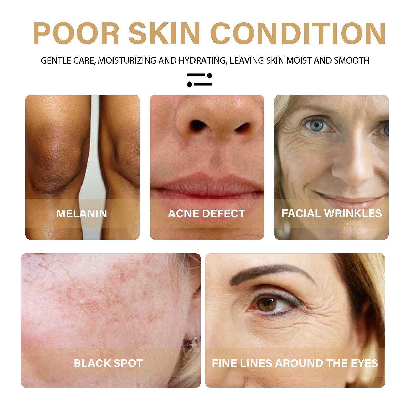 EELHOE Turmeric Dark Spot Correcting Serum Face Care Spot Moisturizing Nourishing Repairing Complexion Serum - MANDOTOS