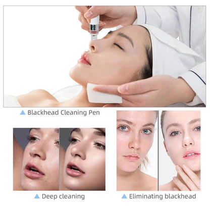 Hydro Water Oxygen Jet Peel Machine Oxy Spray Facial Machine Face Cleaning RF Lifting Dermabrasion Skin Care Beauty Device Spa - MANDOTOS