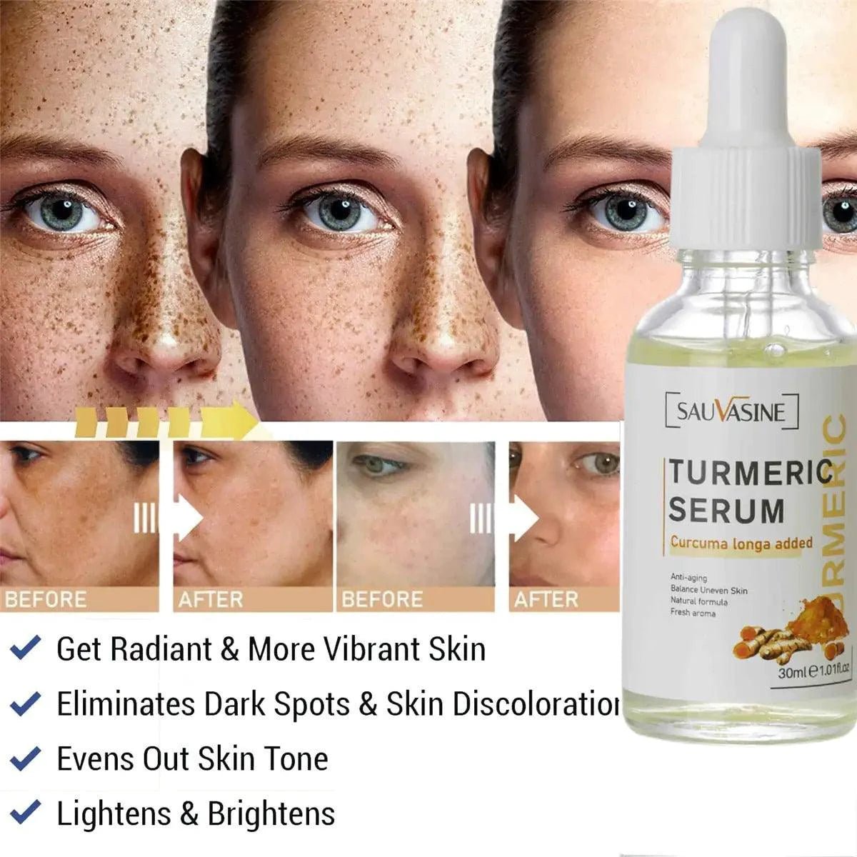 Mandotos BrightGlow Turmeric Radiance Serum bottle with gold accents, showcasing its packaging for glowing skin.