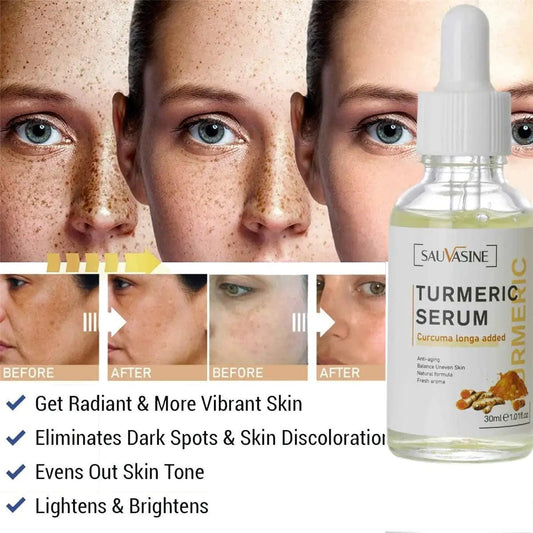 Mandotos BrightGlow Turmeric Radiance Serum bottle with gold accents, showcasing its packaging for glowing skin.