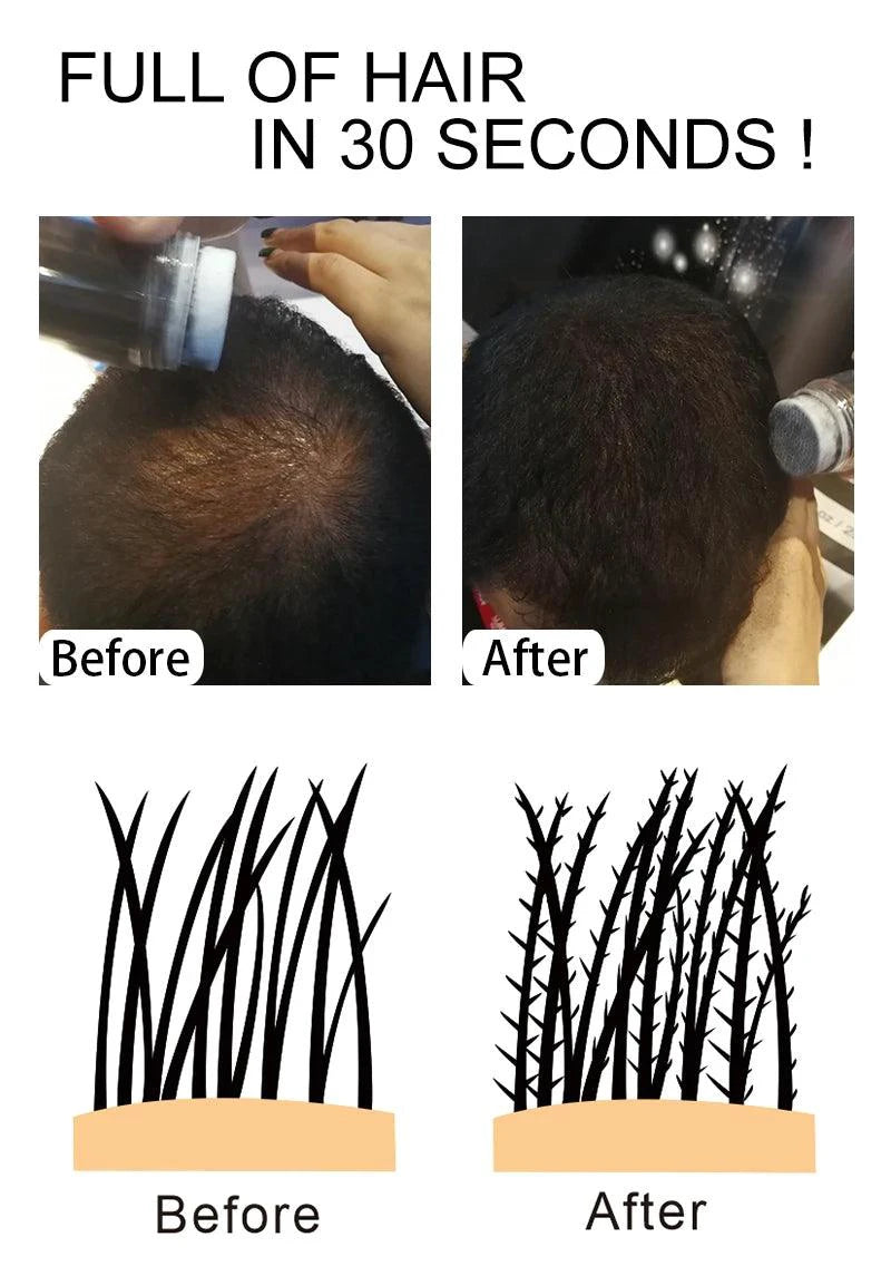Mandotos keratin hair building fibers in 25g container, thickening powder for fuller, natural-looking hair.