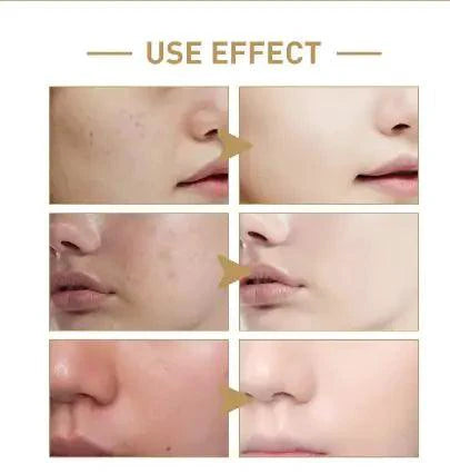 Mandotos Rice Face Toner with hydrating and moisturizing properties, showing a clear bottle of toner with rice extract.