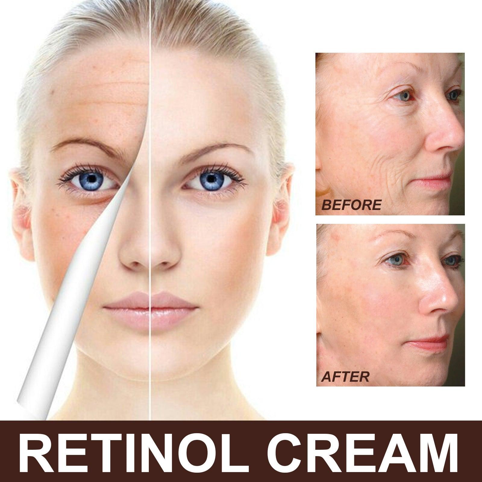 Retinol Anti Aging Wrinkle Removal Skin Firming Cream, EELHOE Retinol Cream Anti-Aging With Hyaluronic Acid And Vitamin - MANDOTOS