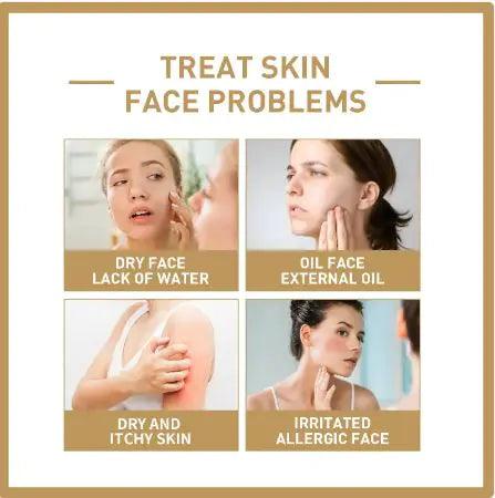 Rice Face Toner - Hydrating & Moisturizing - MANDOTOS